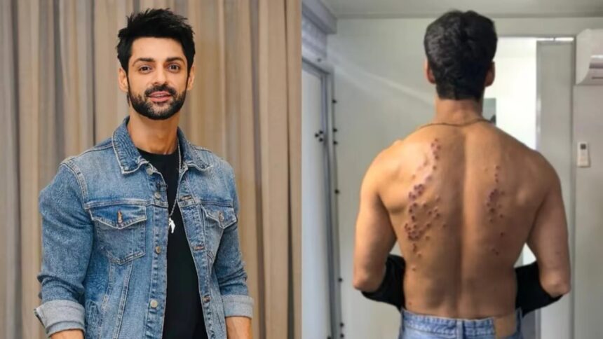 Khatron Ke Khiladi में वाटर व्हील स्टंट करते करण वाही